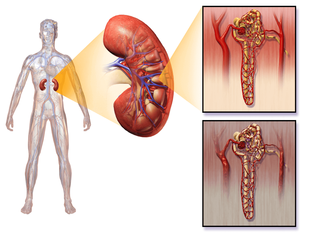 diabetic-nephropathy-health-and-fitness-helps