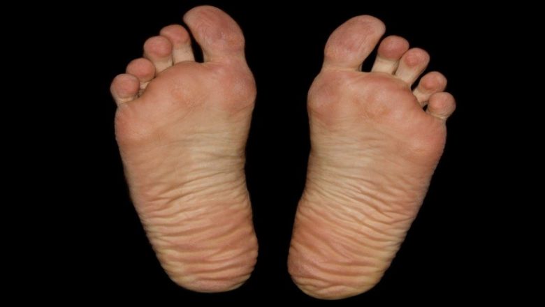 The Most Important Diabetes Foot Facts That Will Enlighten You Richly